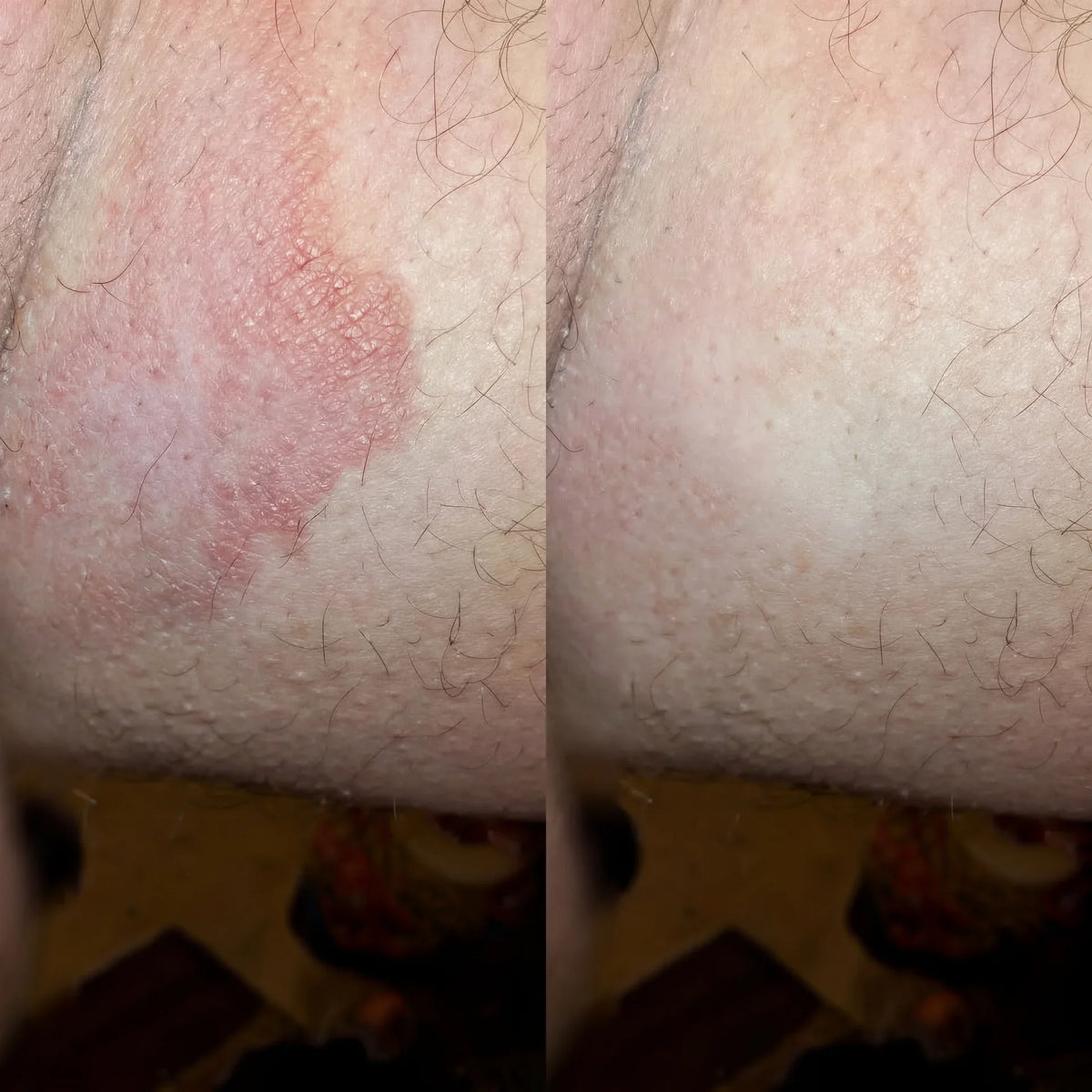 Sapone Antimicotico solieva