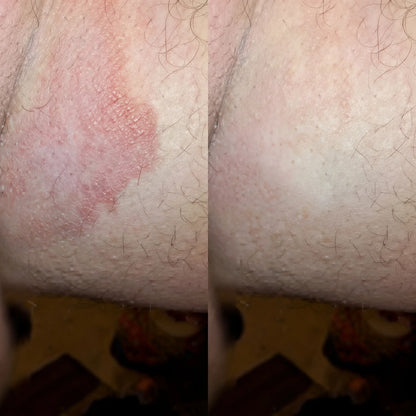 Sapone Antimicotico solieva